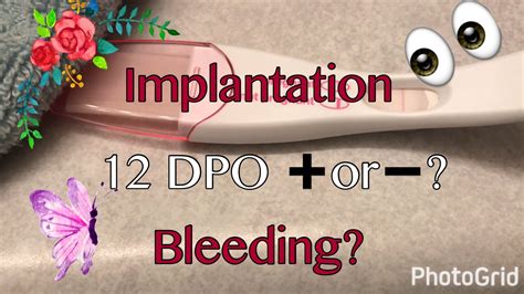 implantation bleeding at 12dpo|More.